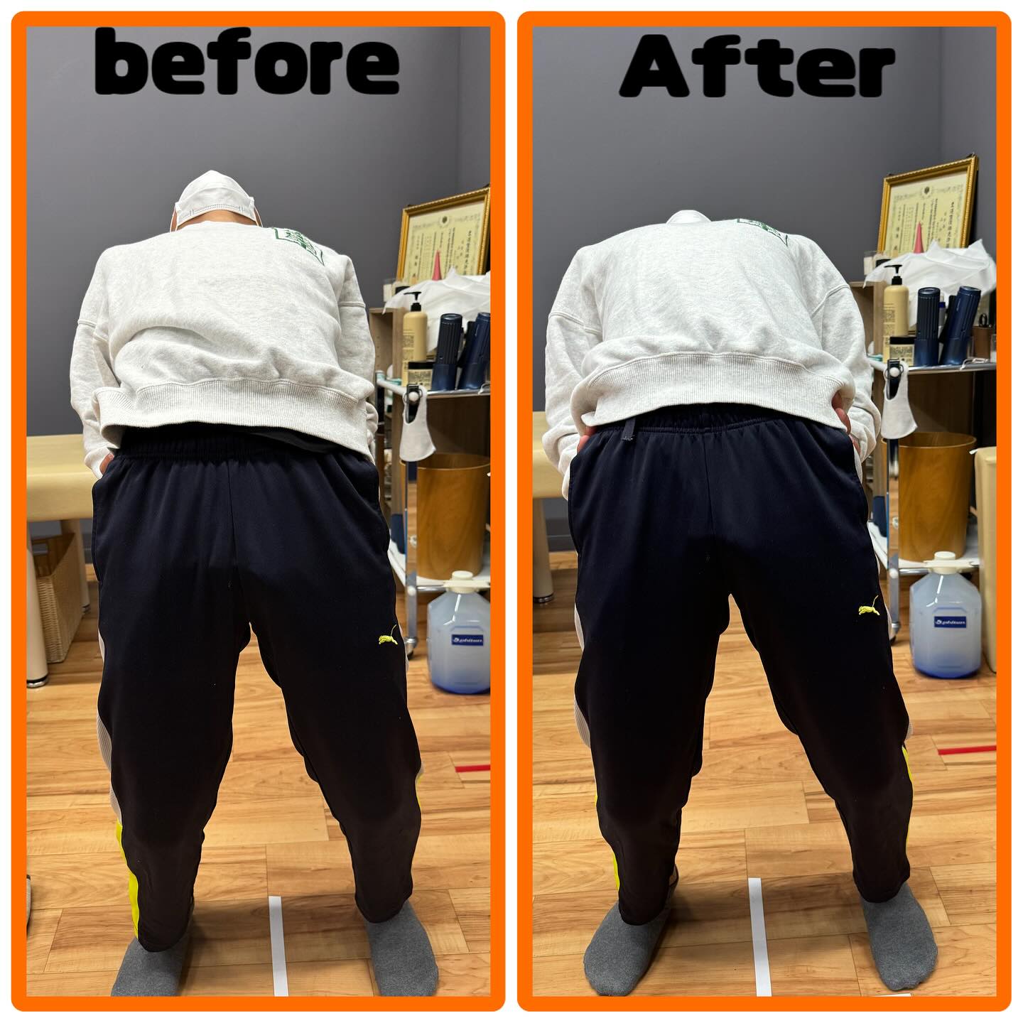 Before / After 2