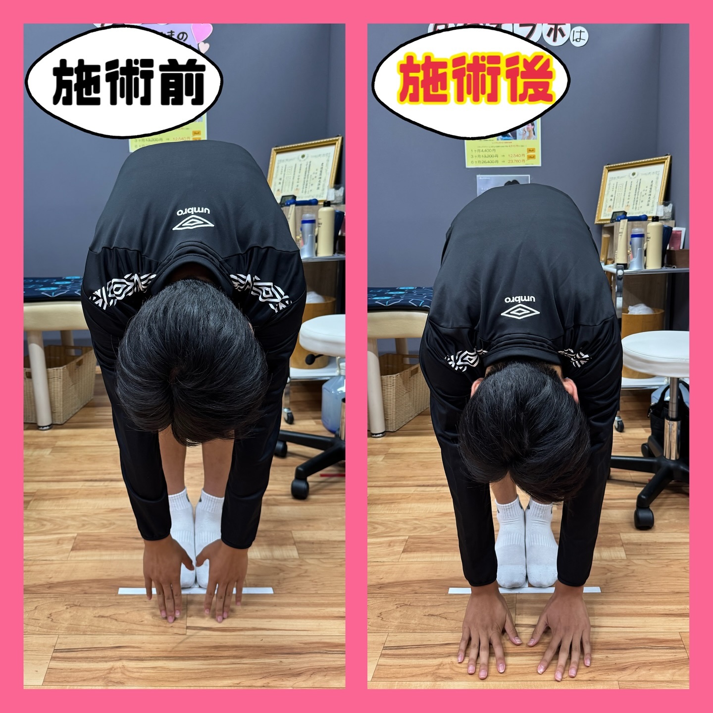 Before / After 3