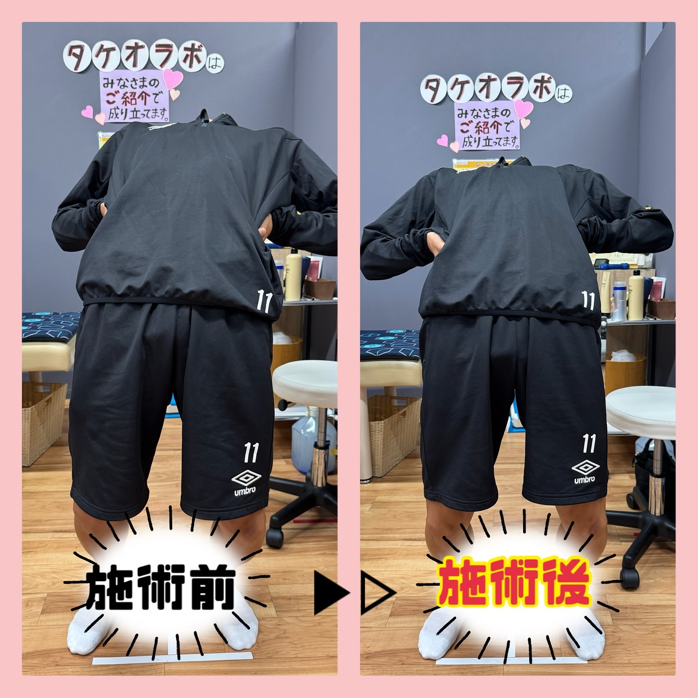 Before / After 4